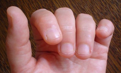 how to stop biting your  nails